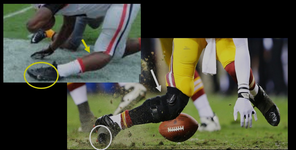 Non-contact knee injury - Washington